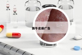 撕牛皮癬廣告