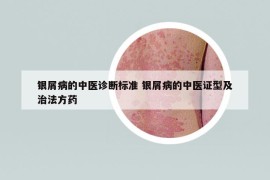 銀屑病的中醫(yī)診斷標(biāo)準(zhǔn) 銀屑病的中醫(yī)證型及治法方藥