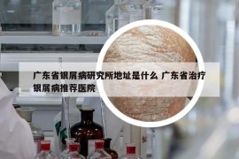 廣東省銀屑病研究所地址是什么 廣東省治療銀屑病推薦醫(yī)院