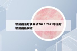 銀屑病治療新突破2023 2021年治療銀屑病新突破