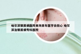 哈爾濱銀屑病醫(yī)院來詢青年醫(yī)學會放心 哈爾濱治銀屑病?？漆t(yī)院