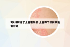 5歲妹妹得了兒童銀屑病 兒童得了銀屑病能治愈嗎