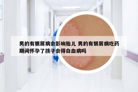 男的有銀屑病會(huì)影響胎兒 男的有銀屑病吃藥期間懷孕了孩子會(huì)得白血病嗎