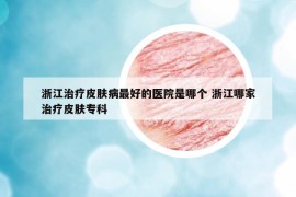 浙江治療皮膚病最好的醫(yī)院是哪個(gè) 浙江哪家治療皮膚專(zhuān)科