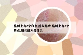 胳膊上有2個(gè)白點(diǎn),越長越大 胳膊上有2個(gè)白點(diǎn),越長越大是什么
