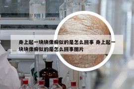 身上起一塊塊像癬似的是怎么回事 身上起一塊塊像癬似的是怎么回事圖片
