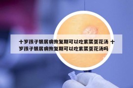 十歲孩子銀屑病恢復(fù)期可以吃紫菜蛋花湯 十歲孩子銀屑病恢復(fù)期可以吃紫菜蛋花湯嗎