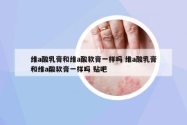 維a酸乳膏和維a酸軟膏一樣嗎 維a酸乳膏和維a酸軟膏一樣嗎 貼吧