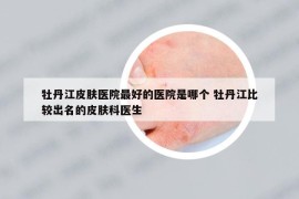 牡丹江皮膚醫(yī)院最好的醫(yī)院是哪個 牡丹江比較出名的皮膚科醫(yī)生