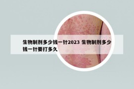生物制劑多少錢一針2023 生物制劑多少錢一針要打多久