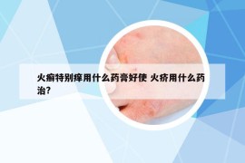 火癬特別癢用什么藥膏好使 火疥用什么藥 治?