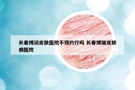 長(zhǎng)春博潤(rùn)皮膚醫(yī)院不預(yù)約行嗎 長(zhǎng)春博瑞皮膚病醫(yī)院