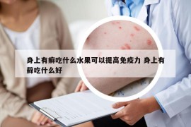 身上有癬吃什么水果可以提高免疫力 身上有蘚吃什么好