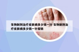 生物制劑治療皮膚病多少錢一針 生物制劑治療皮膚病多少錢一針報銷