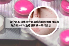 白介素23抗體治療銀屑病在四川哪里可以打 白介素一17a治療銀屑病一周打幾次