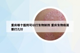 重慶哪個(gè)醫(yī)院可以打生物制劑 重慶生物疫苗要打幾針