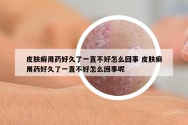 皮膚癬用藥好久了一直不好怎么回事 皮膚癬用藥好久了一直不好怎么回事呢