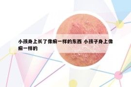 小孩身上長(zhǎng)了像癬一樣的東西 小孩子身上像癬一樣的