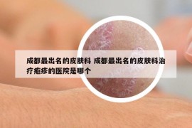 成都最出名的皮膚科 成都最出名的皮膚科治療皰疹的醫(yī)院是哪個(gè)