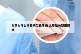 兒童為什么得膿皰型銀屑病 兒童膿包型銀屑病