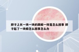 脖子上長(zhǎng)一塊一塊的跟癬一樣是怎么回事 脖子起了一塊癬怎么回事怎么辦