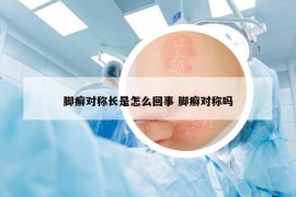 腳癬對(duì)稱長(zhǎng)是怎么回事 腳癬對(duì)稱嗎