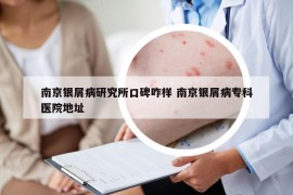 南京銀屑病研究所口碑咋樣 南京銀屑病?？漆t(yī)院地址