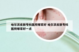 哈爾濱皮膚?？漆t(yī)院哪家好 哈爾濱皮膚?？漆t(yī)院哪家好一點(diǎn)