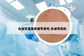 白淑芳是銀屑病專家嗎 白淑萍簡歷