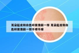 耳朵起皮和白色碎屑像蘚一樣 耳朵起皮和白色碎屑像蘚一樣不疼不癢