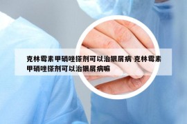 克林霉素甲硝唑搽劑可以治銀屑病 克林霉素甲硝唑搽劑可以治銀屑病嘛