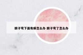 膀子彎下面有癬怎么辦 膀子彎了怎么辦