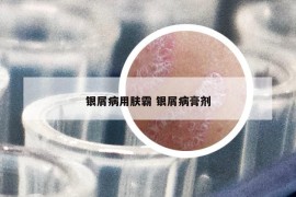 銀屑病用膚霸 銀屑病膏劑