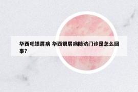 華西吧銀屑病 華西銀屑病隨訪(fǎng)門(mén)診是怎么回事?