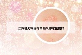 江蘇省無錫治療白癜風(fēng)哪家醫(yī)院好
