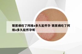 銀屑病吃了阿維a多久能懷孕 銀屑病吃了阿維a多久能懷孕呢