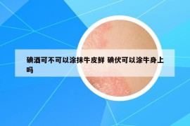 碘酒可不可以涂抹牛皮鮮 碘伏可以涂牛身上嗎