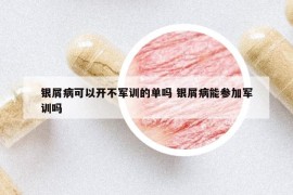 銀屑病可以開不軍訓(xùn)的單嗎 銀屑病能參加軍訓(xùn)嗎
