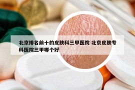 北京排名前十的皮膚科三甲醫(yī)院 北京皮膚專科醫(yī)院三甲哪個好