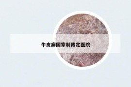 牛皮癬國家制裁定醫(yī)院