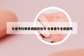 長春專科銀屑病醫(yī)院掛號 長春看牛皮癬醫(yī)院