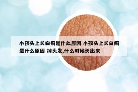 小孩頭上長白癬是什么原因 小孩頭上長白癬是什么原因 掉頭發(fā),什么時候長出來
