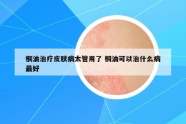 桐油治療皮膚病太管用了 桐油可以治什么病最好