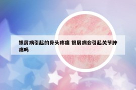 銀屑病引起的骨頭疼痛 銀屑病會引起關(guān)節(jié)腫痛嗎