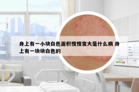 身上有一小塊白色面積慢慢變大是什么病 身上有一塊塊白色的