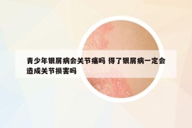 青少年銀屑病會關(guān)節(jié)痛嗎 得了銀屑病一定會造成關(guān)節(jié)損害嗎