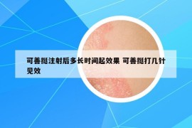 可善挺注射后多長(zhǎng)時(shí)間起效果 可善挺打幾針見(jiàn)效