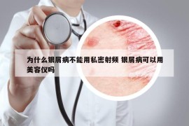 為什么銀屑病不能用私密射頻 銀屑病可以用美容儀嗎