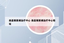 南昌銀屑病治療中心 南昌銀屑病治療中心地址