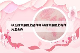 缺乏維生素臉上起白斑 缺維生素臉上有白一片怎么辦
